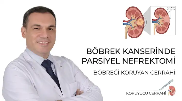 Parsiyel Nefrektomi