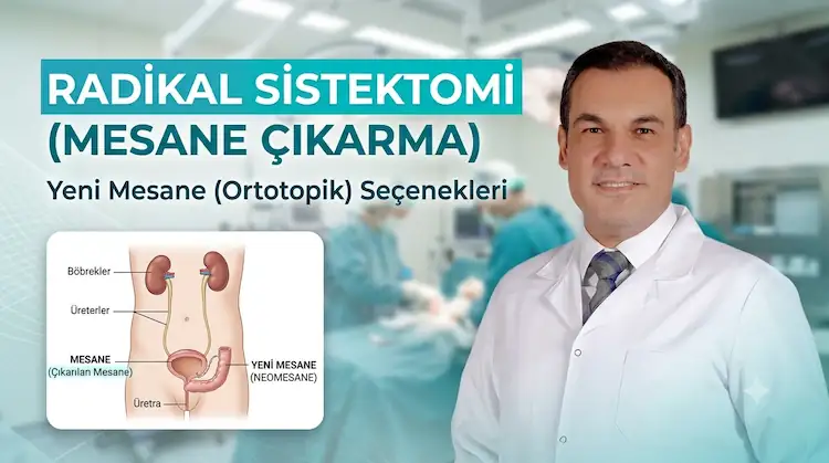 Radikal Sistektomi (Mesane Çıkarma): Yeni Mesane (Ortotopik) Seçenekleri